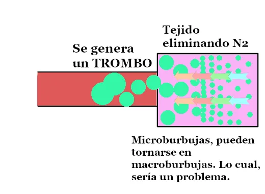 Embolia por ascenso rápido